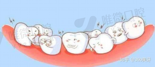 洗牙正规流程（在医院洗牙的步骤）(图1)